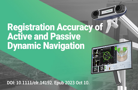 Accuracy of different registration areas using active and passive dynamic navigation systems in dental implant surgery: An in vitro study