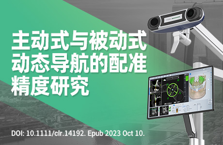 不同配准区域在主动式与被动式动态导航系统牙种植手术中的精度比较：一项体外研究