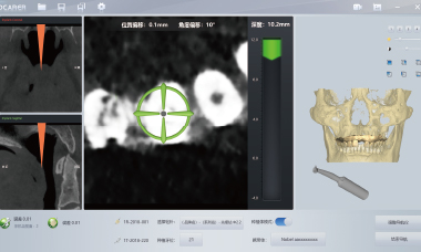 Robotic Arm Auto-Positioning