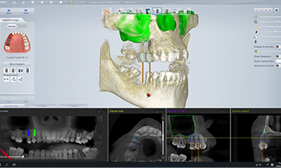 Surgical Treatment Planning