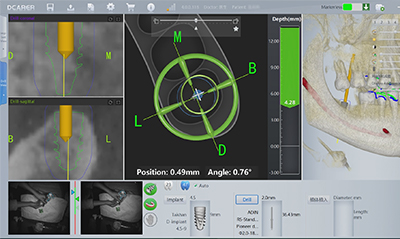 Live Navigation